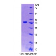 SDS-PAGE analysis of Human CDH15 Protein.