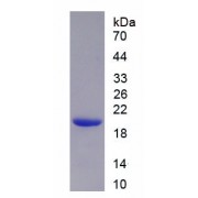 SDS-PAGE analysis of recombinant Human IL8Rb Protein.