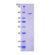 SDS-PAGE analysis of Human S17aH Protein.
