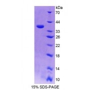 SDS-PAGE analysis of Rat S17aH Protein.