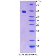 SDS-PAGE analysis of Rat VCC1 Protein.