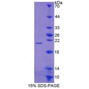 SDS-PAGE analysis of recombinant Human ITGb8 Protein.