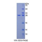 SDS-PAGE analysis of Human GFRa2 Protein.