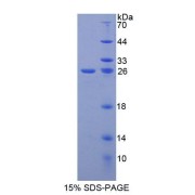 SDS-PAGE analysis of Human GFRa2 Protein.