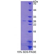 SDS-PAGE analysis of Mouse GFRa2 Protein.