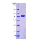 SDS-PAGE analysis of Rat NRG2 Protein.