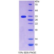 SDS-PAGE analysis of Human ErbB4 Protein.