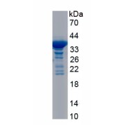 SDS-PAGE analysis of recombinant Human Desmoglein 2 Protein.