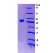 SDS-PAGE analysis of recombinant Human AMPH Protein.