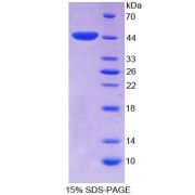 SDS-PAGE analysis of Rat EP300 Protein.