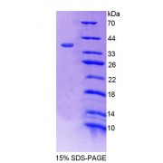 SDS-PAGE analysis of Human ATN1 Protein.