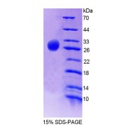 SDS-PAGE analysis of Human GNaZ Protein.