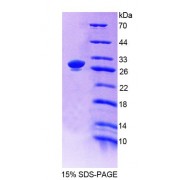 SDS-PAGE analysis of recombinant Human ACTN1 Protein.