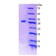 SDS-PAGE analysis of recombinant Human Mediator Complex Subunit 1 (MED1) Protein.