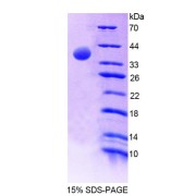 SDS-PAGE analysis of Human EPB41 Protein.