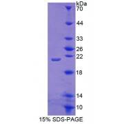 SDS-PAGE analysis of Mouse ACD Protein.