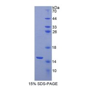 SDS-PAGE analysis of Human ACYP1 Protein.