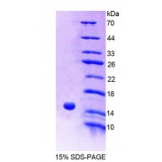 SDS-PAGE analysis of recombinant Human ACYP2 Protein.