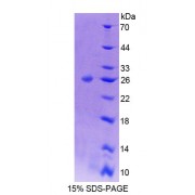 SDS-PAGE analysis of Mouse ADD1 Protein.