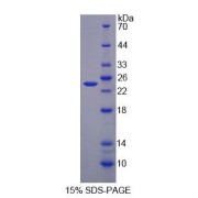 SDS-PAGE analysis of recombinant Human AGXT Protein.
