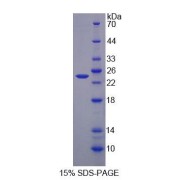 SDS-PAGE analysis of Human AGXT Protein.