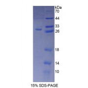 SDS-PAGE analysis of Human AIP Protein.