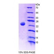 SDS-PAGE analysis of Rat AK2 Protein.