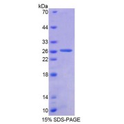 SDS-PAGE analysis of Human AUP1 Protein.