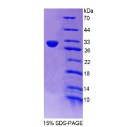 SDS-PAGE analysis of Mouse AURKC Protein.