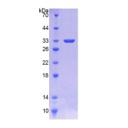SDS-PAGE analysis of Human SERPINC1 Protein.