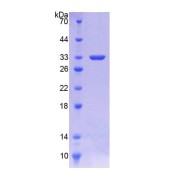 SDS-PAGE analysis of Human AT Protein.