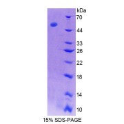 SDS-PAGE analysis of recombinant Rat SERPINC1 Protein.