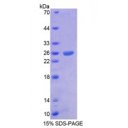 SDS-PAGE analysis of Human ARX Protein.