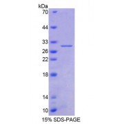 SDS-PAGE analysis of Human AGA Protein.