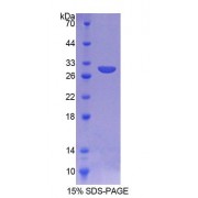 SDS-PAGE analysis of Mouse AGA Protein.