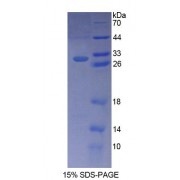 SDS-PAGE analysis of recombinant Human Bcl10 Protein.