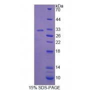 SDS-PAGE analysis of Mouse BCOR Protein.