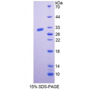 SDS-PAGE analysis of Rat BCHE Protein.
