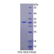 SDS-PAGE analysis of Human CSK Protein.