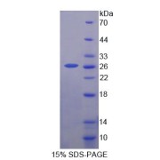 SDS-PAGE analysis of Human CSK Protein.