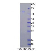 SDS-PAGE analysis of Human CADPS Protein.