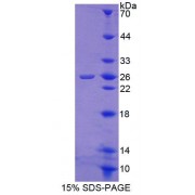 SDS-PAGE analysis of Human CALN1 Protein.
