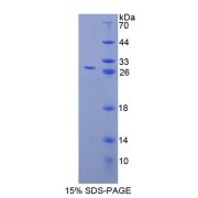 SDS-PAGE analysis of Human CAMLG Protein.