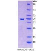 SDS-PAGE analysis of Human CBFb Protein.