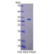 SDS-PAGE analysis of Mouse CBR1 Protein.