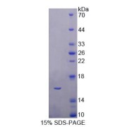 SDS-PAGE analysis of recombinant Human CBY1 Protein.