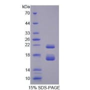 SDS-PAGE analysis of Mouse CBY1 Protein.