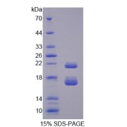 SDS-PAGE analysis of Mouse CBY1 Protein.