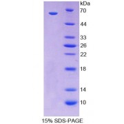 SDS-PAGE analysis of Human CDX2 Protein.