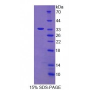 SDS-PAGE analysis of Human CEP110 Protein.